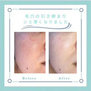 フェイシャルエステLe・Ciel所属・Le・Ciel フェイシャル&ボディのエステ・リラクイメージ