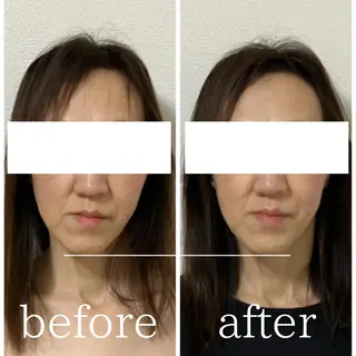 毛穴肌質ケアサロン Yourmeユアミーのエステ・リラクイメージ