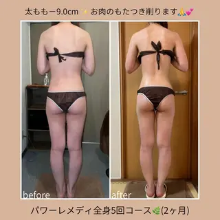 《本気痩せ×疲労改善 》  BILOOPのエステ・リラクイメージ