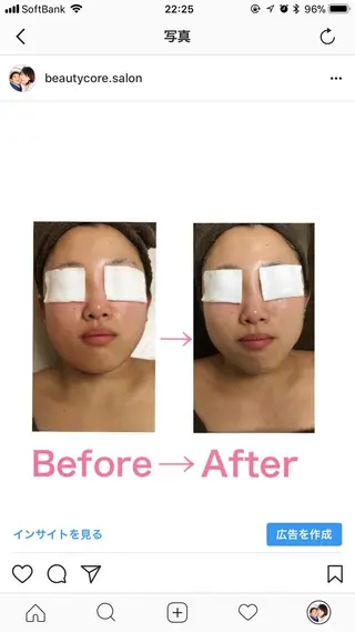 【二子玉川】 ビューティコアのエステ・リラクイメージ