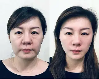 マツエク・マツパ aliaハーブ水光店 エステティシャン募集のエステ・リラクイメージ