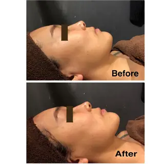 エステ脱毛 MAIのエステ・リラクイメージ