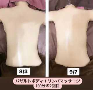 35歳からの エイジングケアサロンのエステ・リラクイメージ