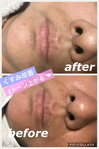 ミディアム カラー パーマ ヘアアレンジ メンズ キッズ ネイル マツエク・マツパ 金の糸脱毛 産毛ケア専門のエステ・リラクイメージ