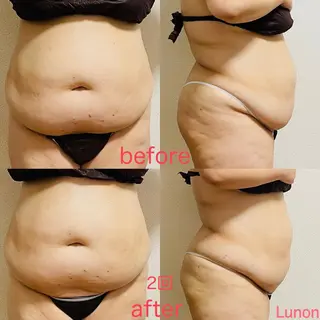 Lunon 【ルノン】のエステ・リラクイメージ