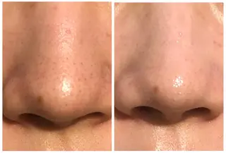 メンズ 美 Faceのエステ・リラクイメージ