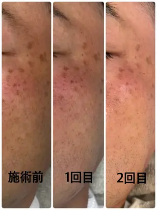 facial salon D 吉沢のエステ・リラクイメージ