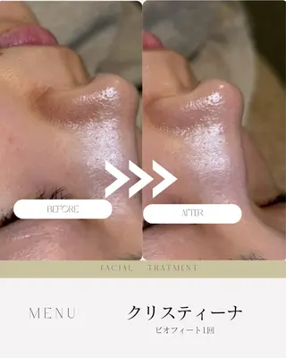 肌質改善✖️ 小顔｜Rikaのエステ・リラクイメージ
