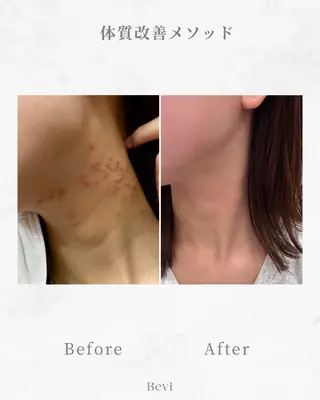 Bevi salonのその他イメージ