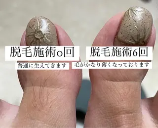 メンズ Anela .のマツエク・マツパデザイン