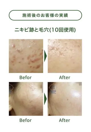 サロンur（ユア） Rieのエステ・リラクイメージ