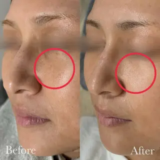 美容鍼脱毛salon リノン吹田駅前店のエステ・リラクイメージ