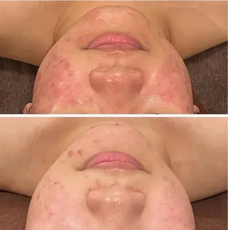 小顔EX心斎橋 REVIハーブのエステ・リラクイメージ