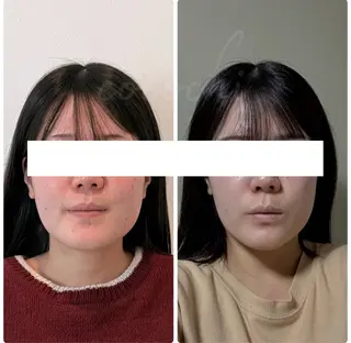 小顔と ヘッドスパのお店のエステ・リラクイメージ