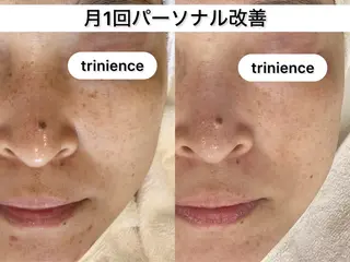 TRINIENCE 南流山店のエステ・リラクイメージ