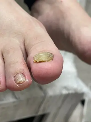 ネイル Belulu ベルルのネイルデザイン