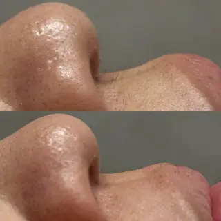 ハーブ&艶肌ワックス re:proのエステ・リラクイメージ