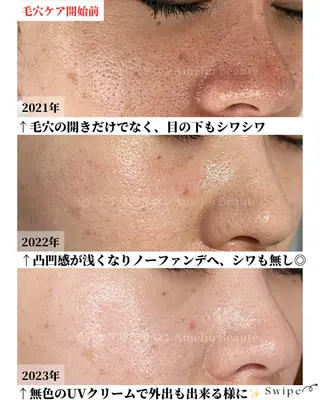 メンズ 毛穴ケア専門サロン アメリオボーテのその他イメージ