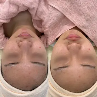 etre - 韓国肌管理 -のエステ・リラクイメージ