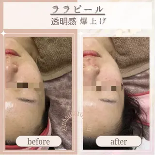 🎀韓国式肌改善🎀 Miku🇰🇷💎のエステ・リラクイメージ