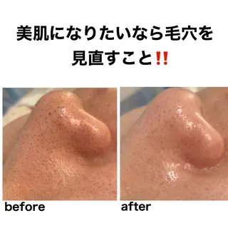 毛穴・シミ専門サロン ルパークのエステ・リラクイメージ