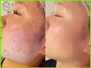 栄 VIO Rのエステ・リラクイメージ