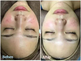 エステティックレイ ビス秋田店　菅野のエステ・リラクイメージ