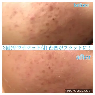 ロング カラー パーマ ヘアアレンジ キッズ ネイル マツエク・マツパ EnsorClair 代表　野口真央のエステ・リラクイメージ