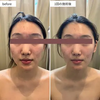 シミ・毛穴ケア専門 クロヌYUKIのエステ・リラクイメージ