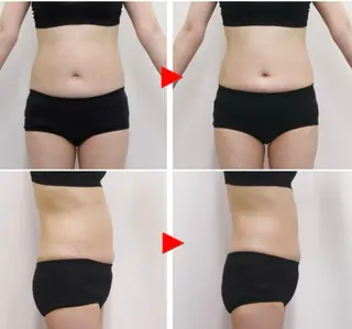 メンズ キッズ ホワイトニングサロン プレジールのエステ・リラクイメージ