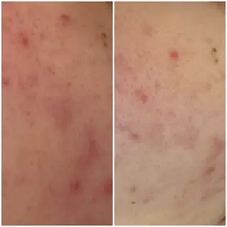 LUARAフェイシャルサロン 新御徒町店所属・ルアラ エステのエステ・リラクイメージ