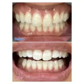 Ｍ渋谷 ホワイトニングのエステ・リラクイメージ