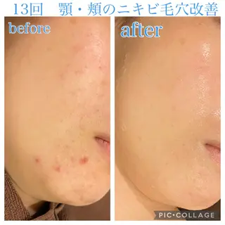 ミディアム カラー パーマ ネイル マツエク・マツパ Ensor Clair所属・EnsorClair 代表 野口真央のエステ・リラクイメージ