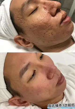 ミディアム aliaハーブ水光店 エステティシャン募集のエステ・リラクイメージ