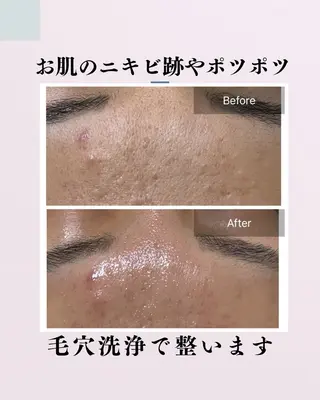 肌質改善サロン facialmoonのエステ・リラクイメージ