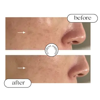 【vidyto】ヴィディトゥ所属・肌管理サロン vidyto　MOEのエステ・リラクイメージ