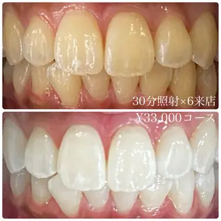 ホワイトニングルーム 横浜店のその他イメージ