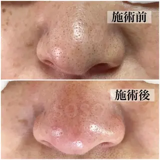 salon soso(ソソ)のエステ・リラクイメージ