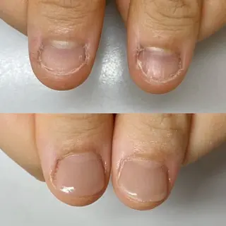 ネイル ネイルサロン アリュームのネイルデザイン
