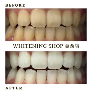 メンズ ホワイトニング ショップ葛西店のその他イメージ