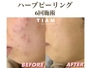 美肌サロンTIAM by tetoteのエステ・リラクイメージ