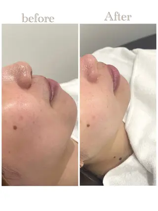 お肌の角質ｹｱ / ﾍﾞﾗｽﾃｷﾞのその他イメージ