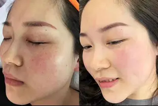 愛維美水光美肌専門店 メンズレディースokのエステ・リラクイメージ