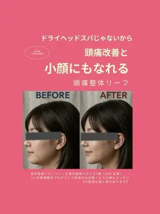 頭痛専門店 リーフ 武蔵浦和店のその他イメージ