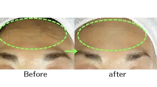 自然派フェイシャル やながわのエステ・リラクイメージ