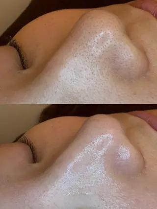 🤍アベシュリ /フェイシャル🤍のエステ・リラクイメージ