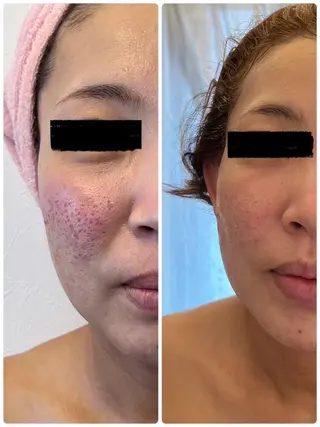 BLESS BEAUTYのエステ・リラクイメージ