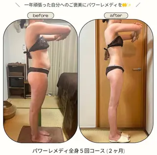 《本気痩せ×疲労改善 》  BILOOPのエステ・リラクイメージ