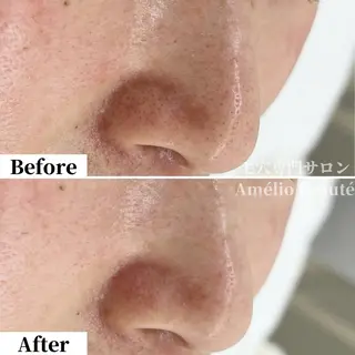 毛穴ケア専門サロン アメリオボーテのその他イメージ