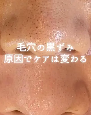 private beauty salon Lilby所属・リルビー 肌育・肌質改善サロンのその他イメージ